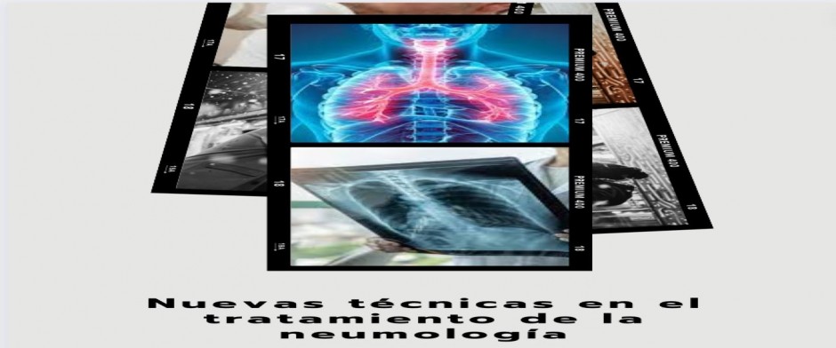 Nuevas t&eacute;cnicas en el tratamiento de la neumolog&iacute;a