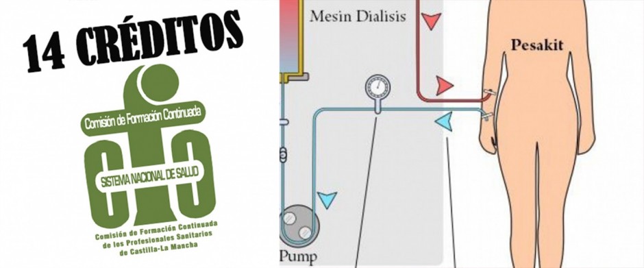 CONCEPTOS TEÓRICOS EN HEMODIÁLISIS