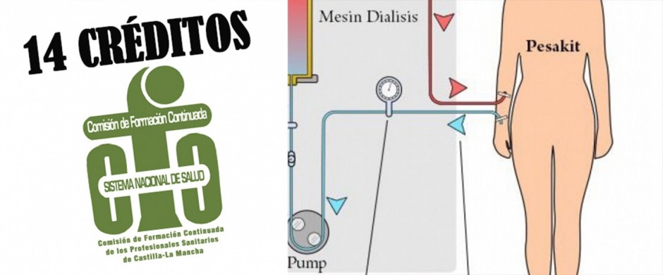 CONCEPTOS TE&Oacute;RICOS EN HEMODI&Aacute;LISIS