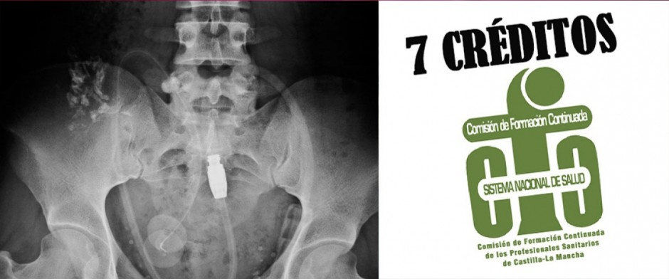 2. DI&Aacute;LISIS PERITONEAL PARA TCAE. 7 CR&Eacute;DITOS